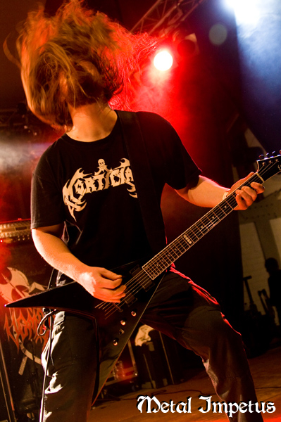 Vomitory