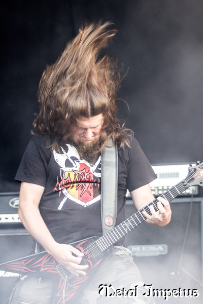 Vomitory